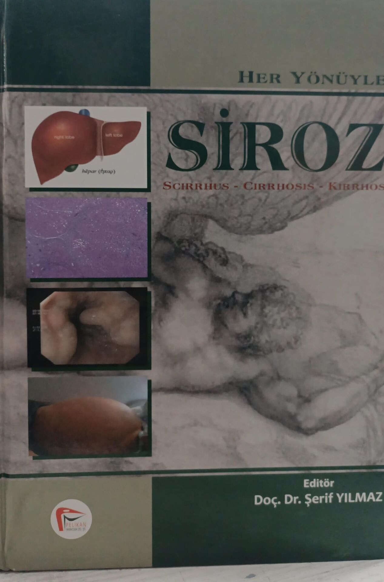 Her Yönüyle Siroz - Şerif Yılmaz