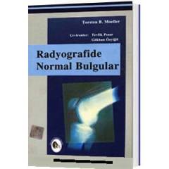 Radyografide Normal Bulgular